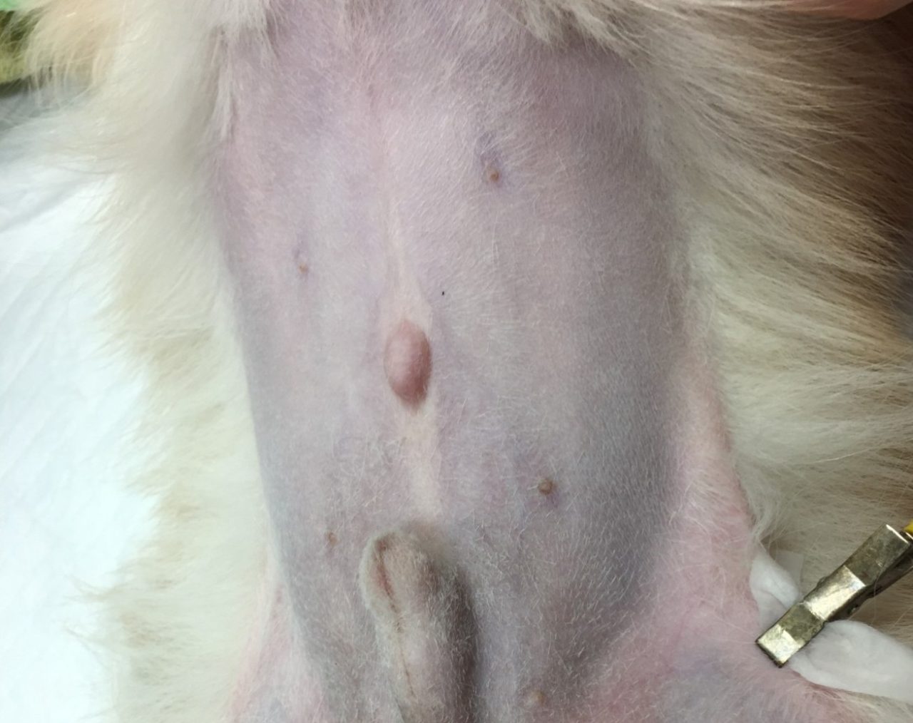 医師は臍ヘルニアをどのように診断するか