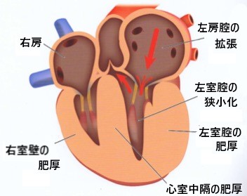 肥大型心筋症｜京都市左京区の動物病院「かもがわ動物医療センター」