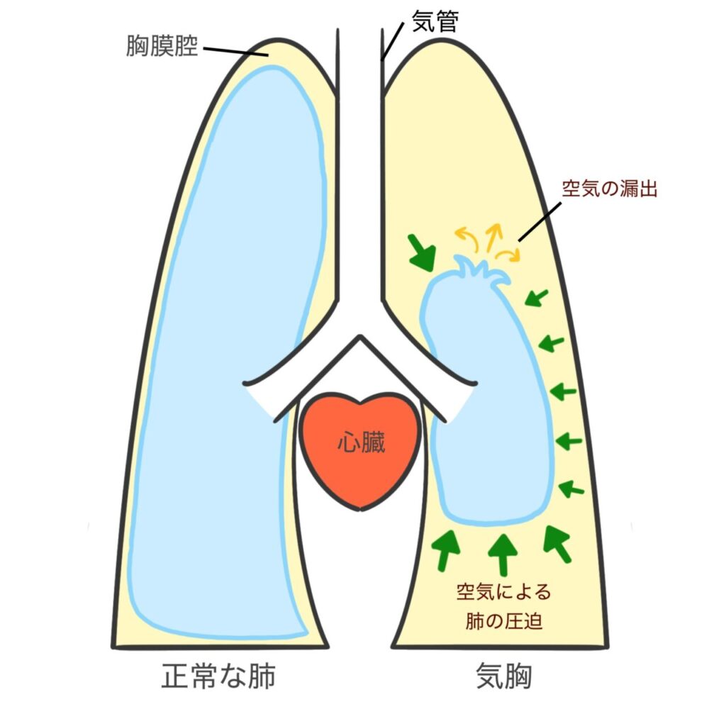 気胸|京都市左京区の動物病院「かもがわ動物医療センター」